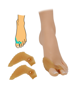 Korektor hallux valgus s návlekem na prst - 2 ks