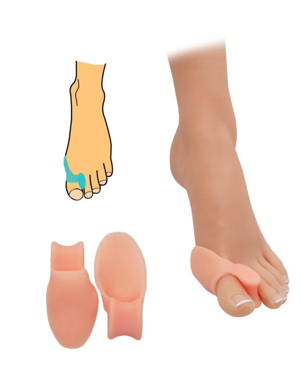 Chránič a korektor hallux valgus - tělový